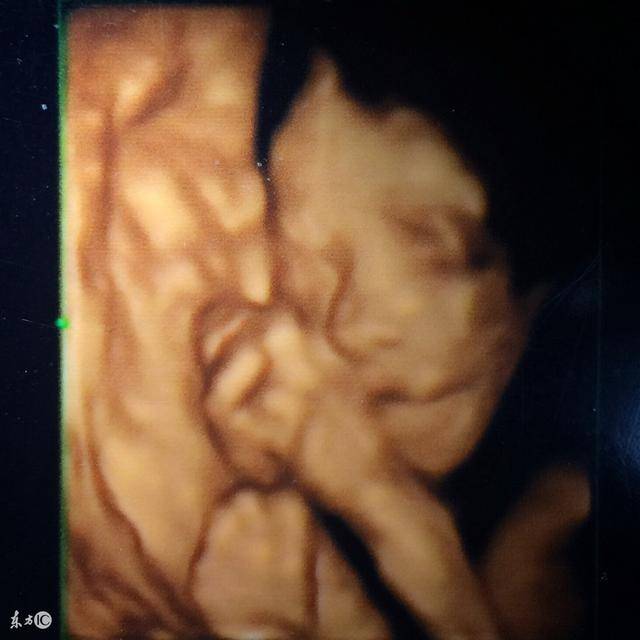 胎儿姿势看男女 肚子图片