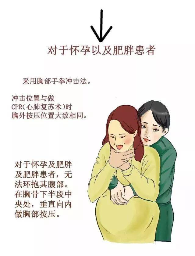 微漫画 | 急救现场系列——儿童及成人气道异物梗阻怎么办?