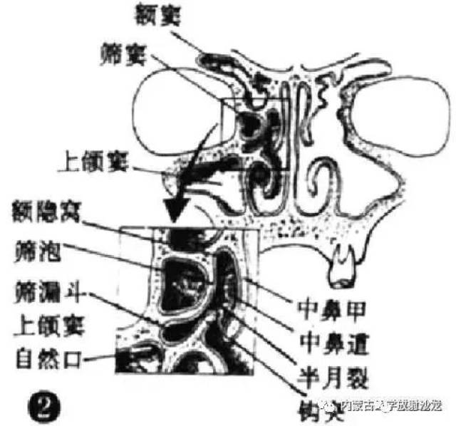 鼻和鼻窦的正常解剖及常见变异