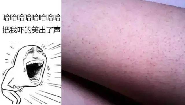 鸡皮肤发炎是不是会长痘(鸡皮肤发炎是不是会长痘痘)