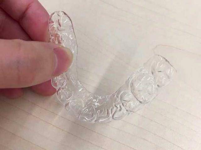一年多牙套,告别大龅牙是一种什么样的体验?