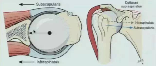 必读 肩袖损伤的诊断和治疗技巧