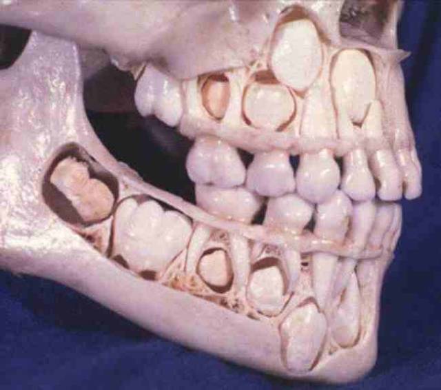 6,一个孩子的头骨,这是他的乳牙脱落之前