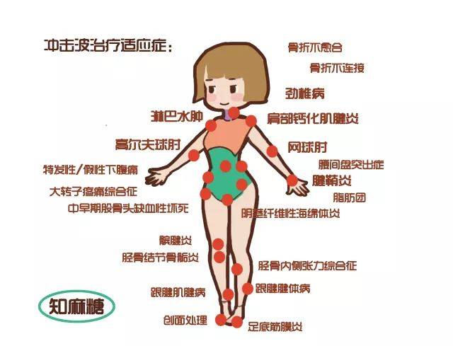 虽然猛一转头 颈部痛点还是会有一丢丢的痛, 但是已经好转了太多太多