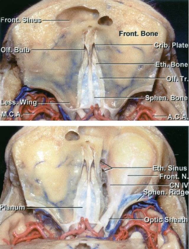 嗅沟脑膜瘤手术策略与技巧 the neurosurgical atlas全文翻译