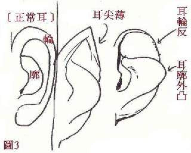 反骨耳,反骨耳士,反骨耳图片(第3页)_大山谷图库