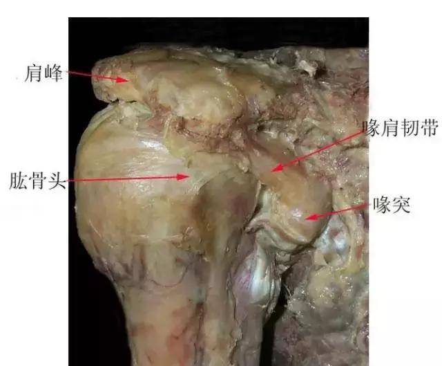 怎么预防肩峰撞击综合症,保护好自己的肩部?
