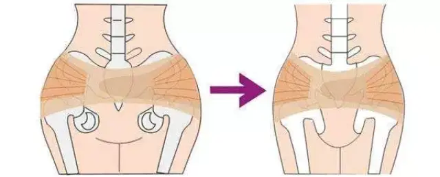 产后收髋很重要,不仅关系到你的身材,更关系到你的健康