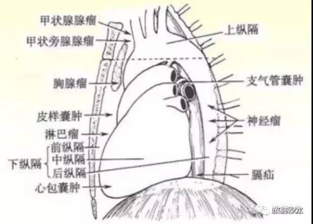 纵隔解剖   纵隔疾病x线诊断要点