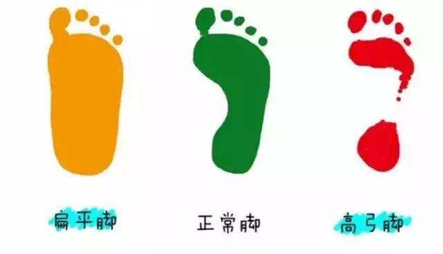 由于不同宝宝的脚型可能不同