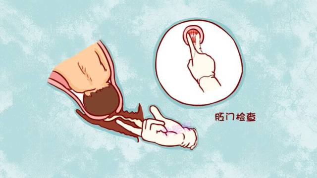 2,当宫口开了3指时,孕妈妈就可以进待产室了,从宫口开3指到全开一般