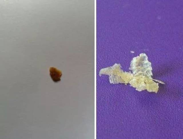 你的耳屎是干的还是湿的?不许笑,严肃点!我们搞科研呢!