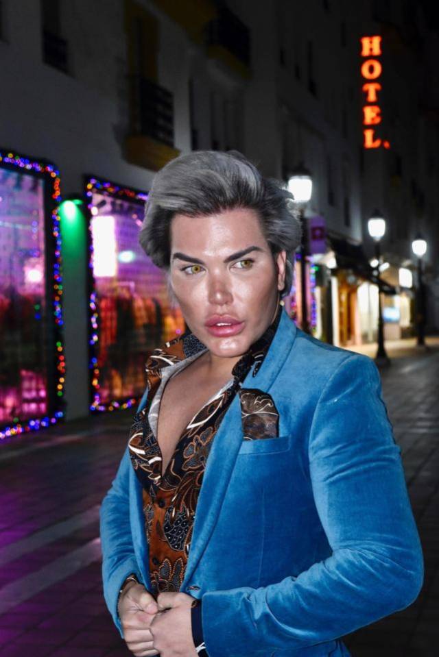 巴西整容狂魔摘除4根肋骨,自称将留着骨头做其他手术