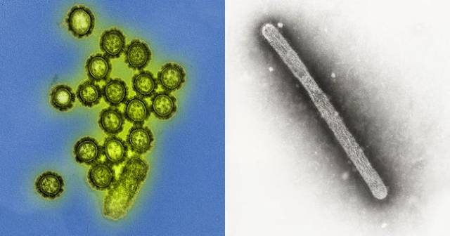 左图:电子显微镜观察到的h1n1流感病毒;右图:电子显微镜观察到的h5n1