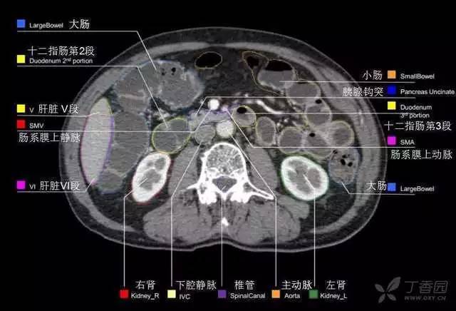 最实用的上腹部 CT 图谱,看过的医生都收藏