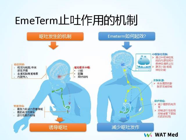 其实很简单 通过刺激手腕的神经,阻止大脑向胃部传输呕吐的信号