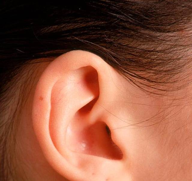 耳前淋巴癌早期症状图图片