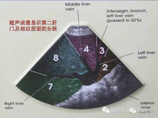 肝脏8段分法的影像学解剖