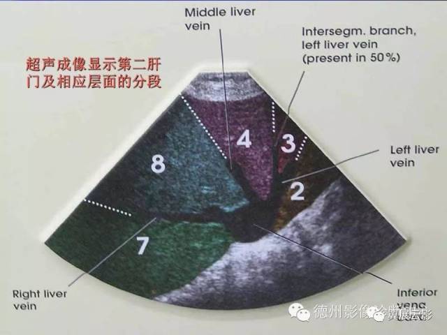 肝脏超声分段图片