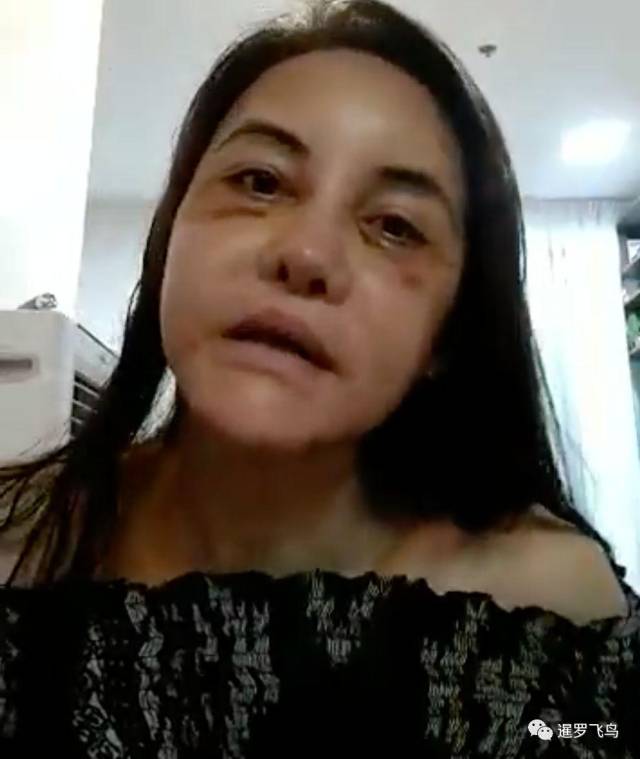 泰国女艺人韩国整容变毁容 发文警醒手术变美靠运气