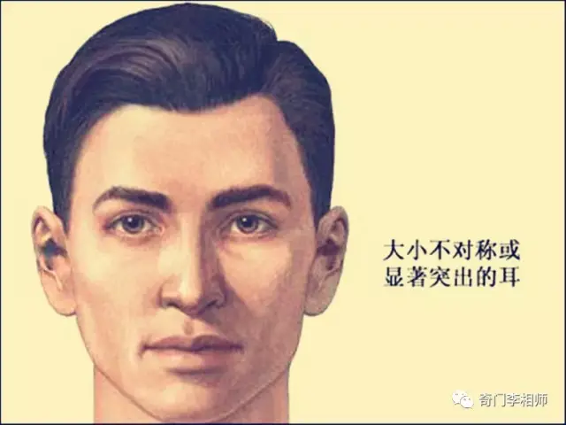 2,耳朵不对称.