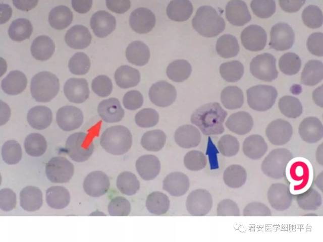间日疟原虫滋养体图片