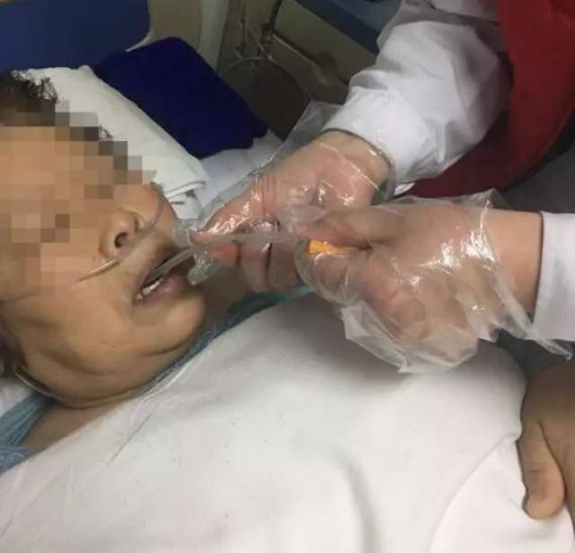 【健康】努力前行,无问西东——间歇经口至食管管饲法