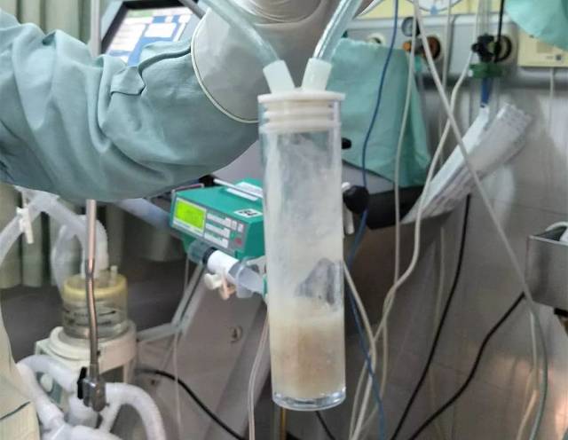 【医疗技术】我院icu开展纤支镜肺泡灌洗术