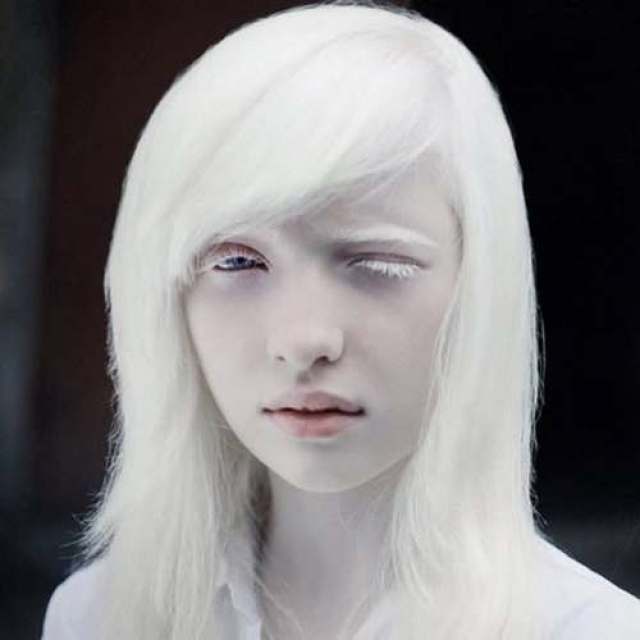 nastya zhidkova,俄罗斯女孩,被誉为世界上最漂亮的白化病姑娘