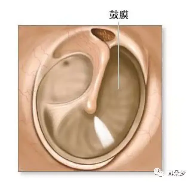 耳朵内部鼓膜正常图片图片