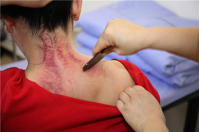 她们用15天摆脱了多年的亚健康问题,还学会了这三种