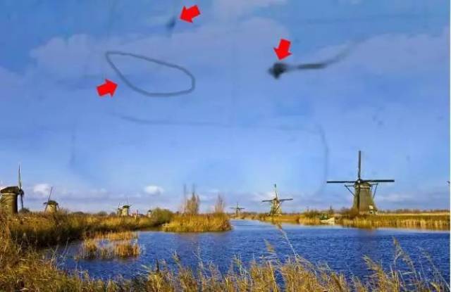 恶性飞蚊症居然能引发严重的眼疾