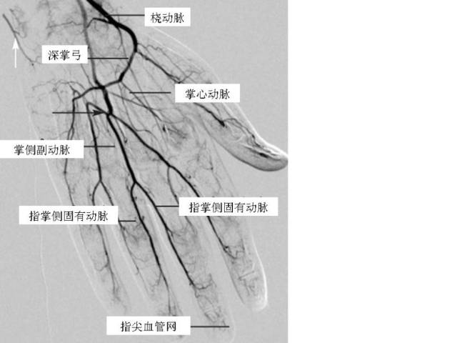 图解:四肢血管造影(dsa)及介入操作规范