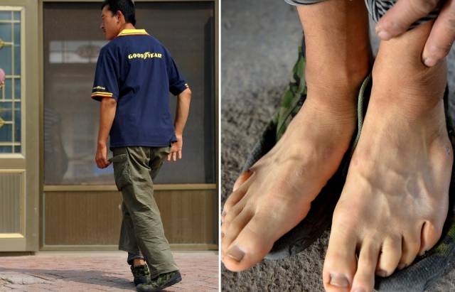 三口人"一条腿" ,走出精彩人生