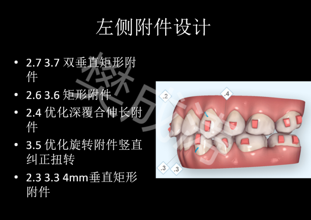 左侧片切对正中线 6.压低下前牙1.5mm左右 7.上颌24副牙套