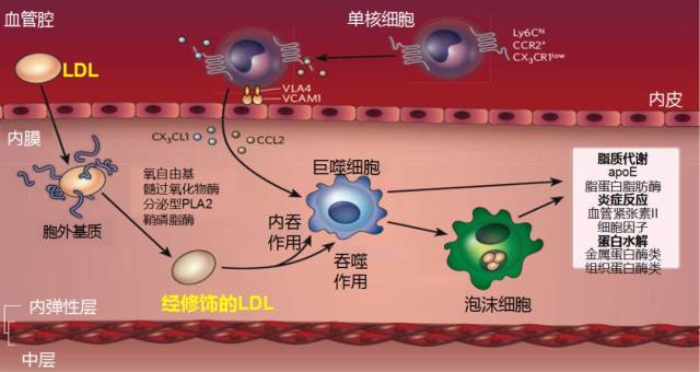 富含胆固醇的ldl进入血管壁内[3] 动脉粥样硬化斑块的发生,发展机制[3