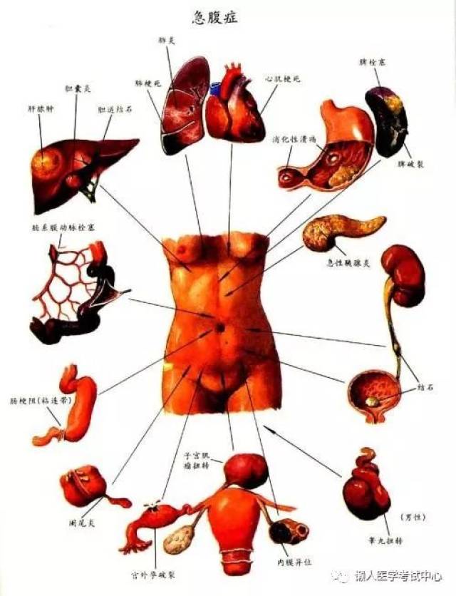 男性左上腹疼痛位置图图片