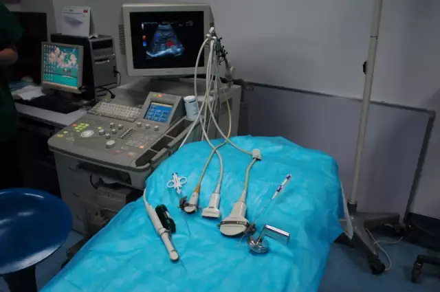 【细说疾病】囊肿那些事儿——超声介入治疗