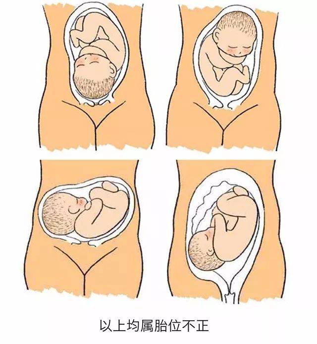 胎位图男女男孩图片