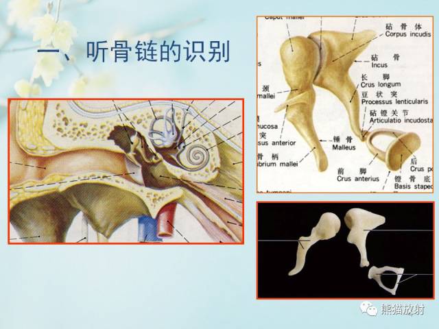 面神经鼓室段图片