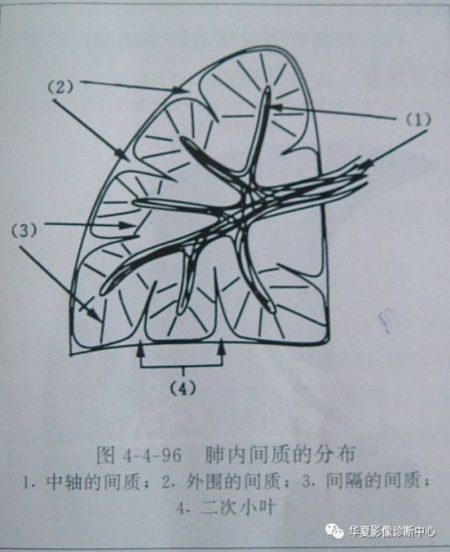 肺小叶 结构图图片
