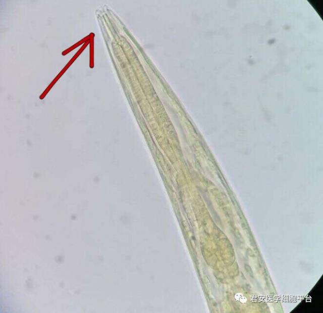 钩虫显微镜下形态图片图片