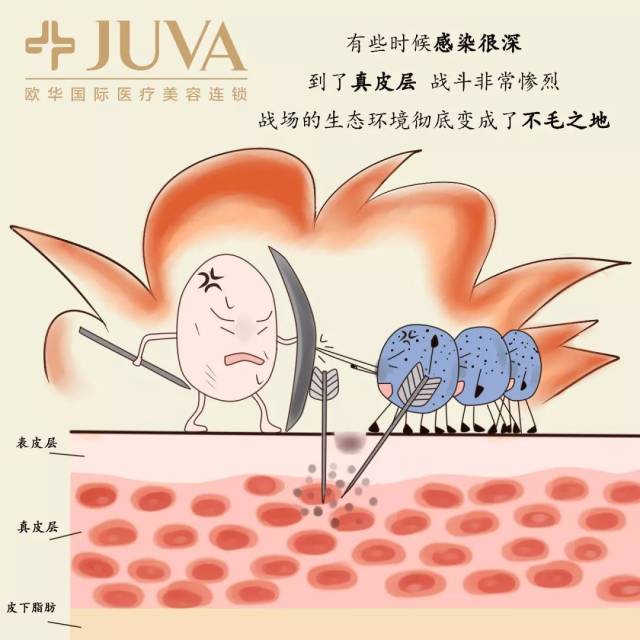 漫话医美:痘印、痘坑毁一生?真有那么恐怖?!