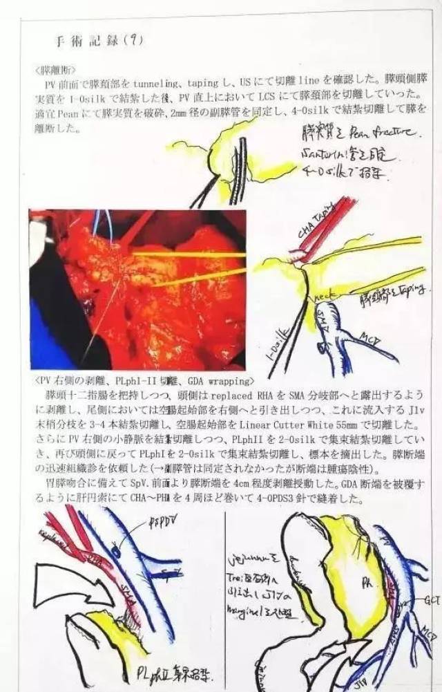 看到日本醫院的這份手術記錄,我震驚了!