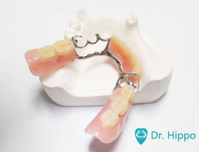 活动假牙日常如何维护