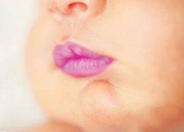 宝宝口唇发紫图片
