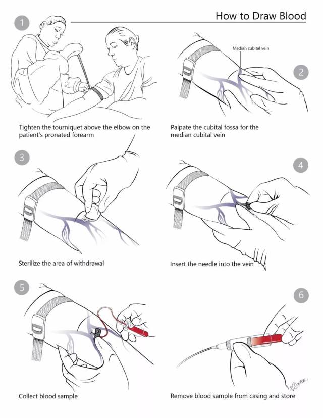 抽血进针手法图图片