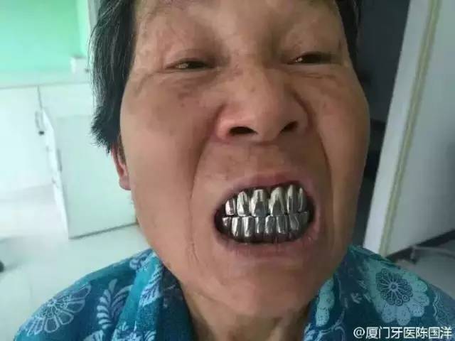 这是哪个牙医做的,你出来,我保证不打你!