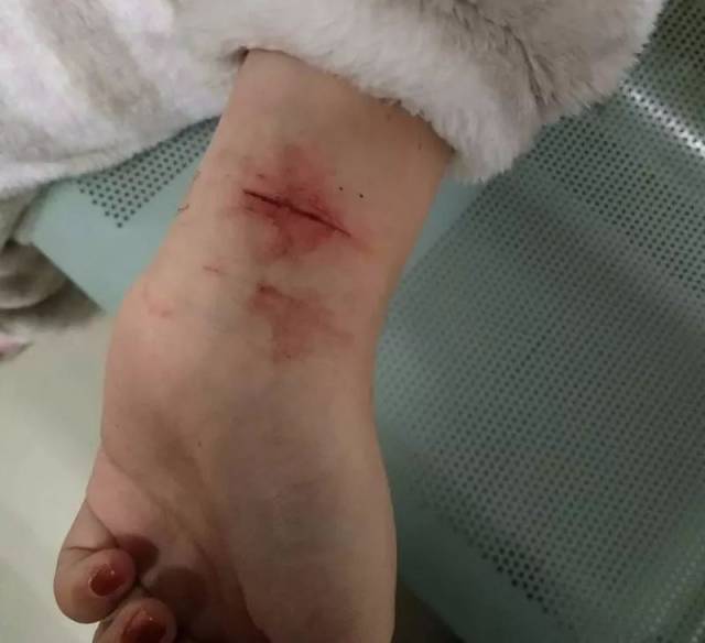 民警还发现车辆副驾驶坐位上有一把带血的刀片,而孙某左手腕也有刀片