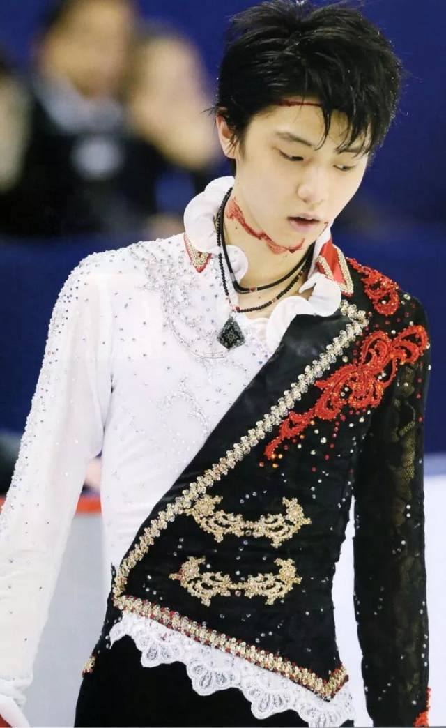 2014年自由滑中國站比賽練習時,羽生結弦與中國選手閆涵相撞.